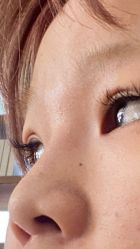 体验后-上海玫瑰医疗美容医院