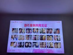 -成都苗方清颜专业祛痘