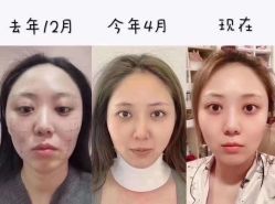 -贝黎诗SPA