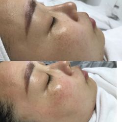 -凡碧诗毛孔收细