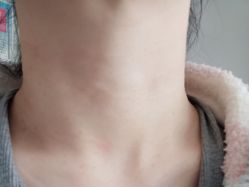 点击看大图 体验后-大连美天医疗美容医院
