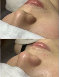 -尊尚柏丽美容SPA