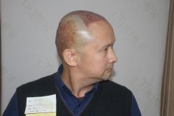 -熙朵美学植发·连锁品牌