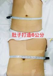 -Lily纤美·科技减脂中心