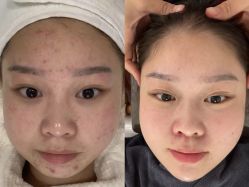 -SKIN79皮肤管理中心