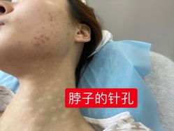 -杭州医巢医疗美容