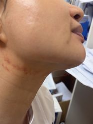 -长沙雅美医疗美容医院