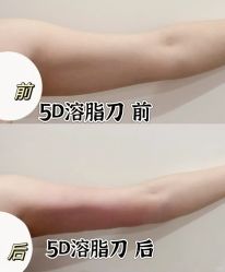 -Lily纤美·科技减脂中心