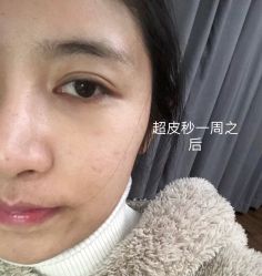 -Yestar宁波艺星整形医院