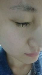 android_upload_pic-光SPA科技美肤