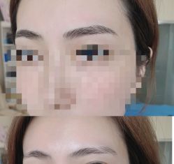 点击看大图 -西施无菌半永久纹绣眉眼影唇轻增发纹发际线