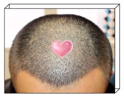 -大麦微针植发全国连锁