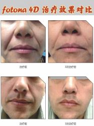 -北京米扬丽格医疗美容·联合丽格鼻整形中心