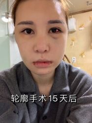 -大华韩艺整形美容医院