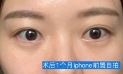 -八大处整形