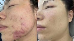 -Cream88颜皮肤管理中心