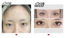 -素美医疗美容·西南眼鼻整形·修复基地