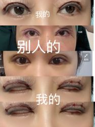 -天津伊美尔医疗整形美容专科医院