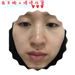 -净颜专业祛斑祛痘