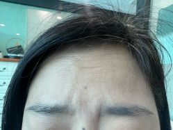 -洁铭新加坡医美