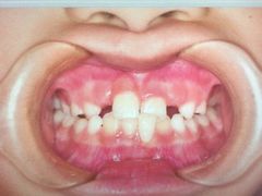 -天使口腔门诊部(上海店)