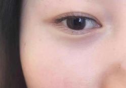 -晶禾臻语·问题肌研究所