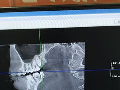 -土豆口腔(凤凰北总店)