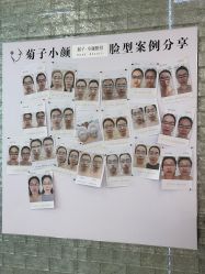 点击看大图 -菊子小颜·日式整骨·产后管理
