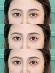 点击看大图 -杨益美学·野生眉半永久纹眉发际线