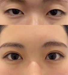 -Yestar 嘉兴艺星医疗美容医院