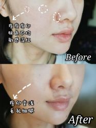 点击看大图 -美壹生诊所皮肤管理中心·海菲秀&Legacy美白舱