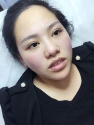 -郡艺医疗美容·微整·眼鼻吸脂