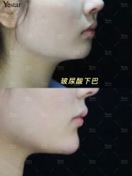 -Yestar艺星医疗美容医院