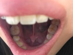 -爱贝口腔·牙周诊疗·种植修复中心