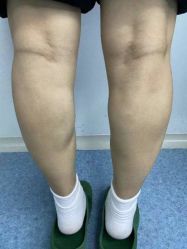 -郡艺医疗美容·微整·眼鼻吸脂