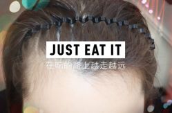 -大麦微针植发全国连锁