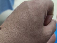 -北京熙仁医院眼科·近视手术专科