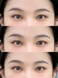 点击看大图 -杨益美学·野生眉半永久纹眉发际线