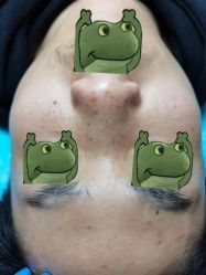 -清疣美疣·痣·斑净肤中心