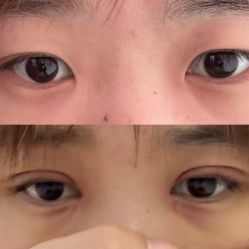 -JustHer宁波珈禾医疗美容医院