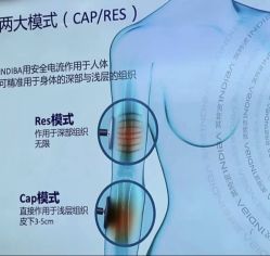 -半岛故事·法儿曼抗衰·indiba中心