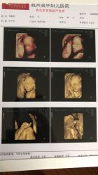 -杭州贝瑞斯美华妇儿医院·早孕·产检·儿科