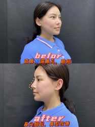 -天津时光诺颜·轻医美·轮廓抗衰中心