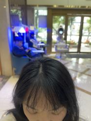 -碧莲盛·不剃发植发