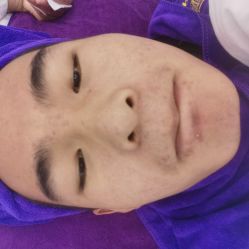 -蕾特恩专业祛痘国际连锁