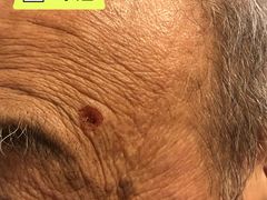 -复旦大学附属华山医院(总院)