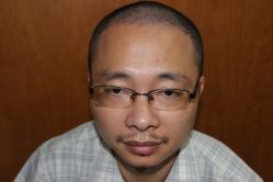 点击看大图 -大麦微针植发丨全国连锁