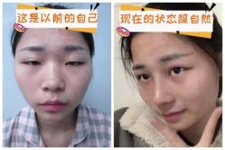 -素美医疗美容·西南眼鼻整形·修复基地