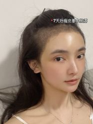 -雍禾植发全国连锁