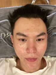 -ROYEA茹彦祛痘·问题肌肤修护中心